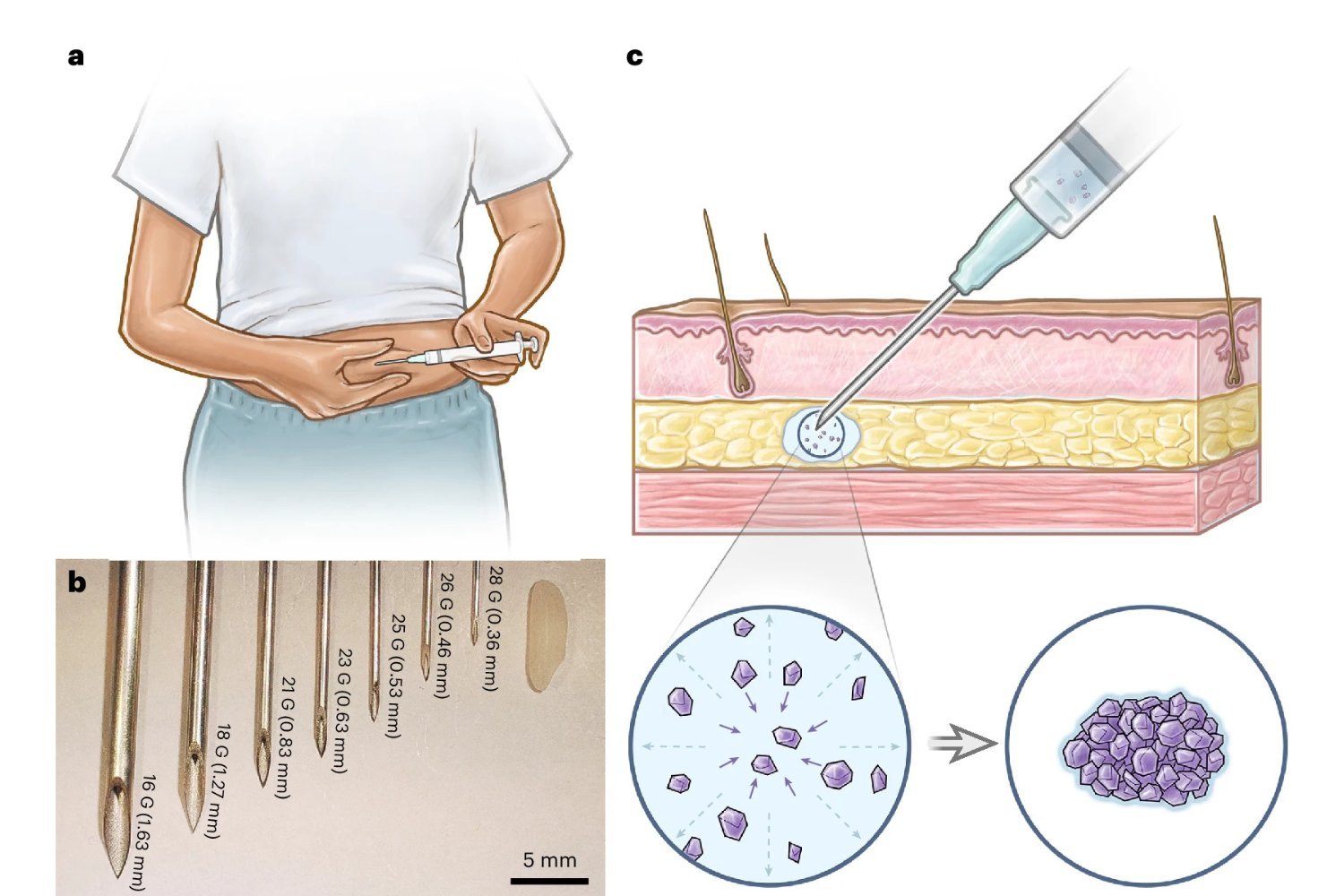 An artist's rendering of the newly developed SLIM contraceptive technology.